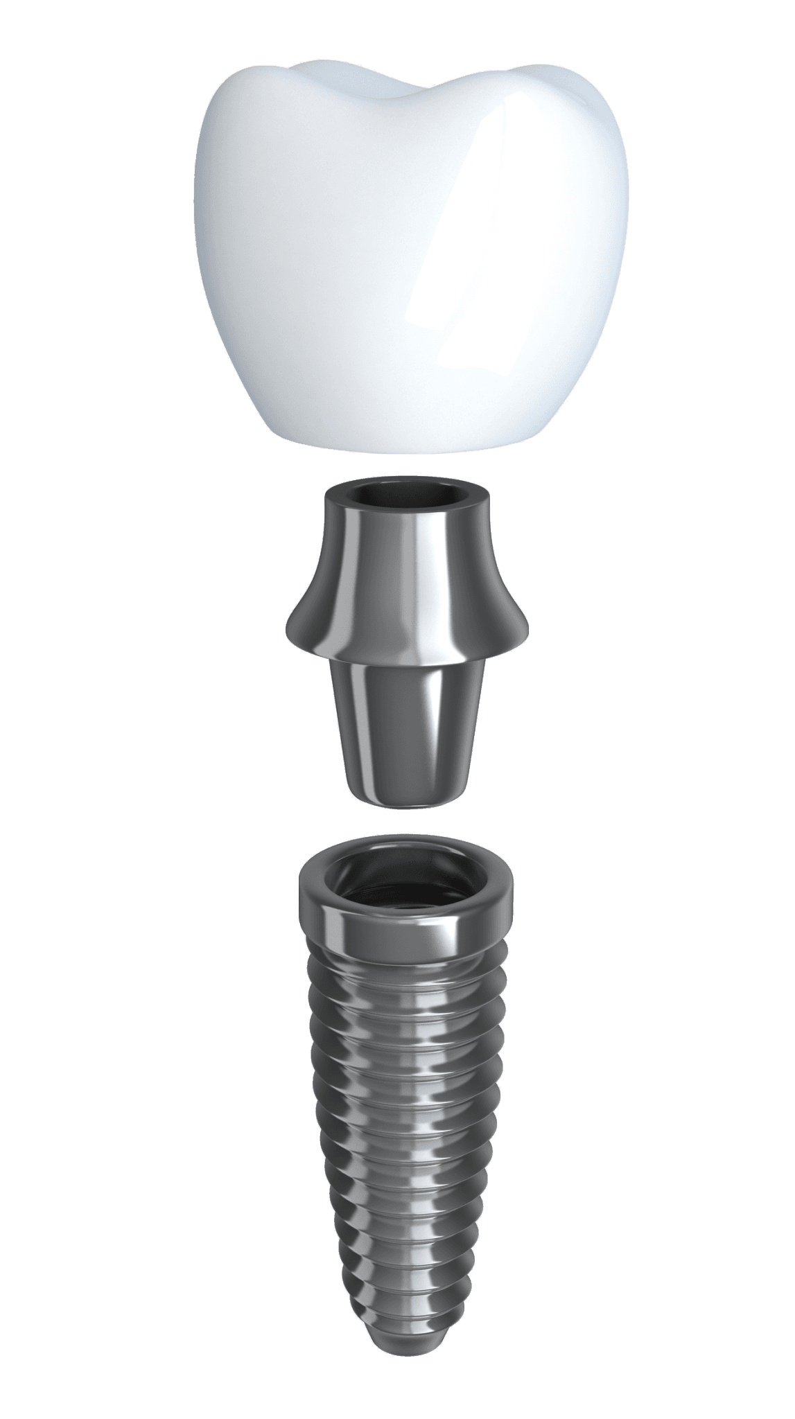 Full-mouth reconstruction and advanced restorative dentistry in Fairfax VA