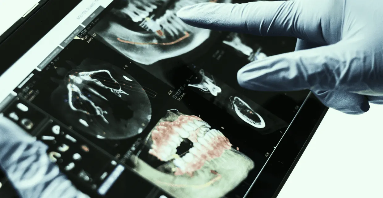 Dentist reviewing digital X-ray and CBCT scans